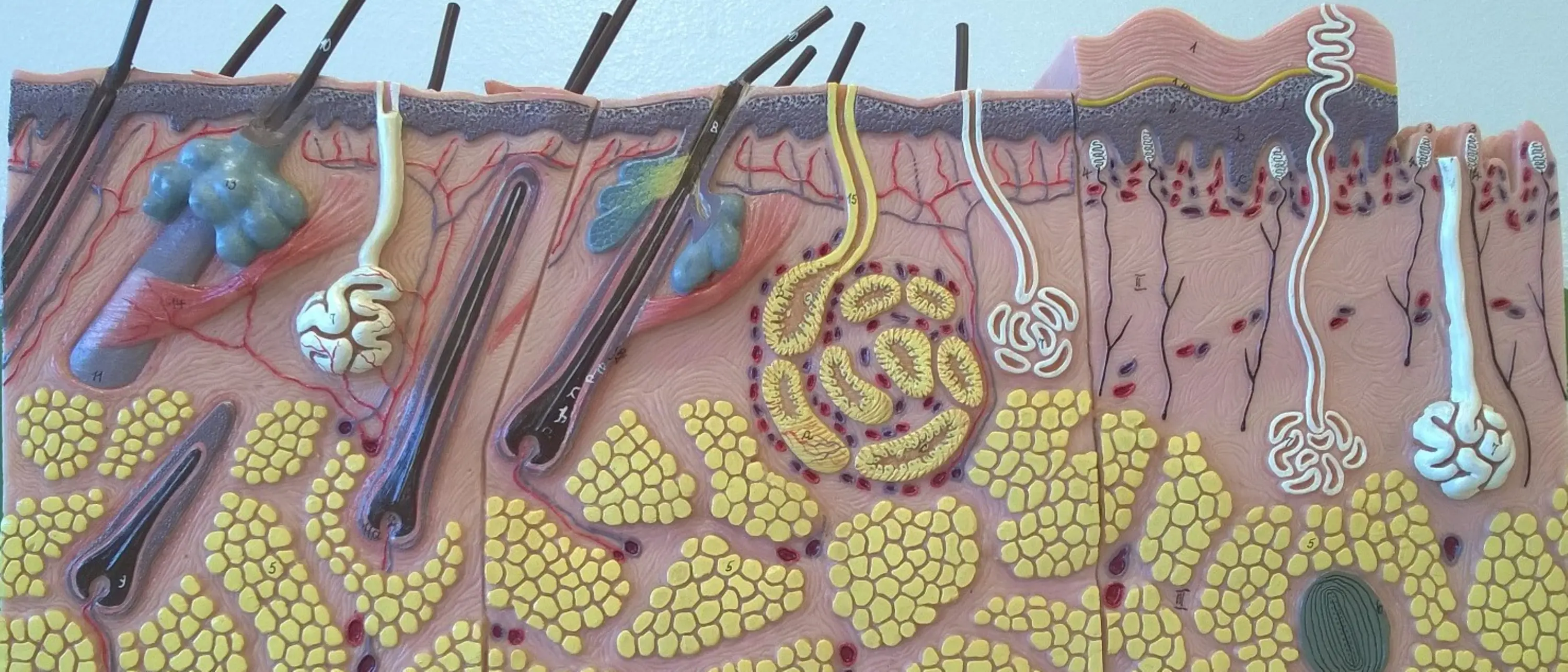 Plastic model of skin cross section